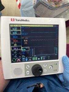 Monitor showing organ vital statistics for the TransMedic machine