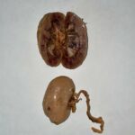 Plasticized kidneys, one fo them split open to see the inside
