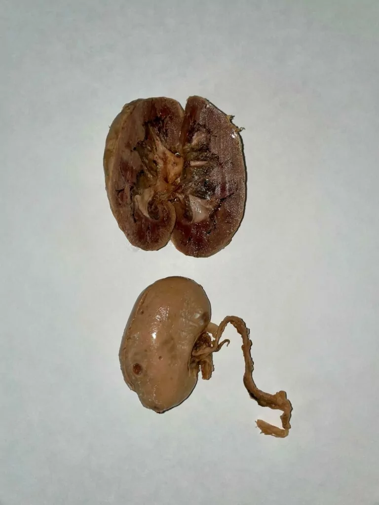 Plasticized kidneys, one fo them split open to see the inside