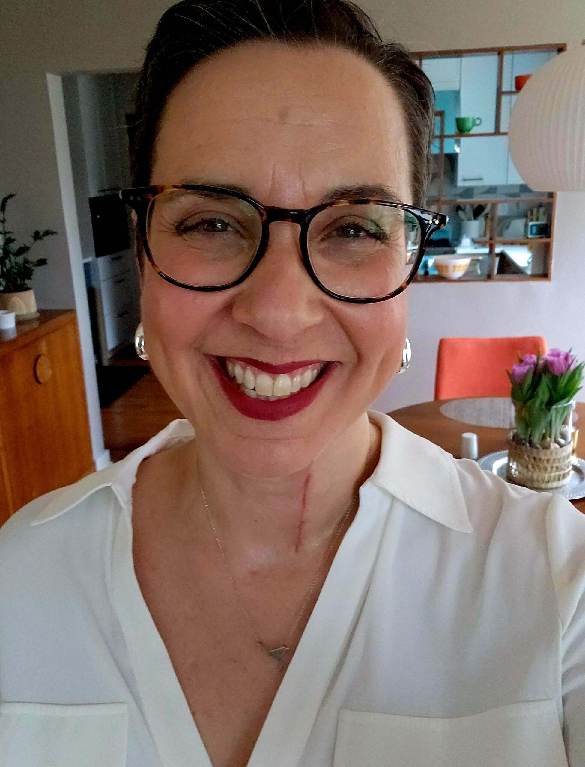 Robin Miner-Swartz has a scar on her neck and a smile on her face.